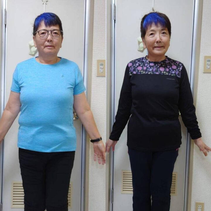 偏頭痛改善/糖尿（a1c)改善/猫背改善/膝痛改善の69歳　女性の画像