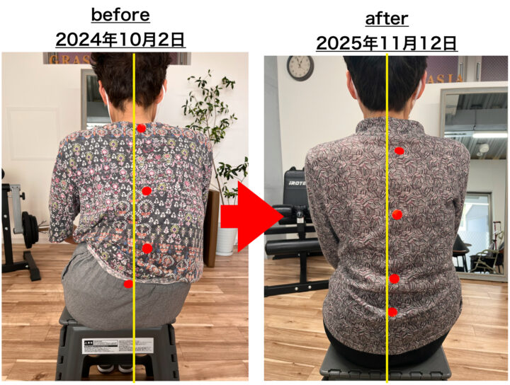 シルバーカーを卒業したいあなたへ ——もう一度“自分の足で歩く”ためにできること——の画像